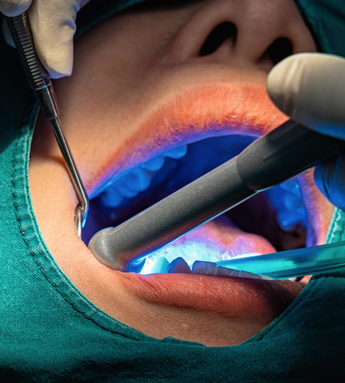 Clínica Manso Laranjo - Cirugia Oral