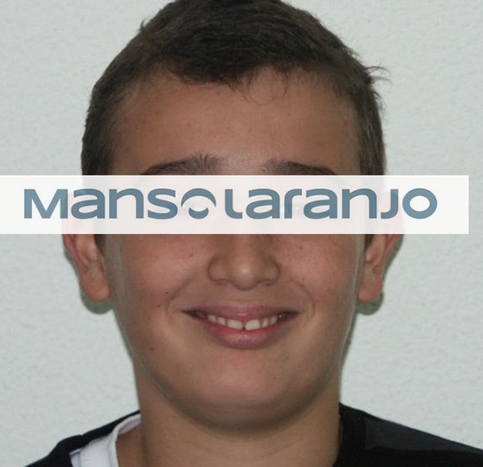 Tratamento Dentário - Clínica Manso Laranjo