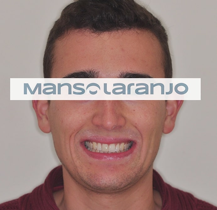 Tratamento Dentário - Clínica Manso Laranjo