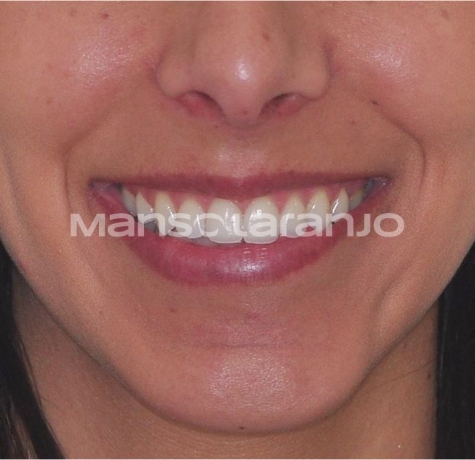 Tratamento Dentário - Clínica Manso Laranjo