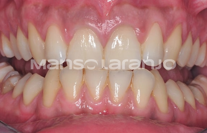 Tratamento Dentário - Clínica Manso Laranjo