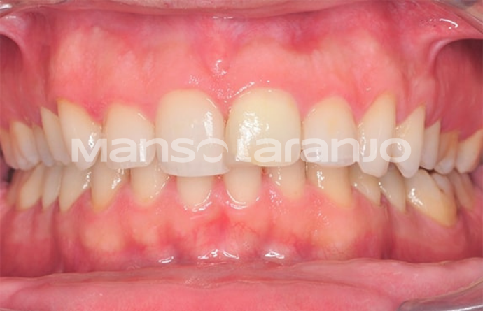 Tratamento Dentário - Clínica Manso Laranjo