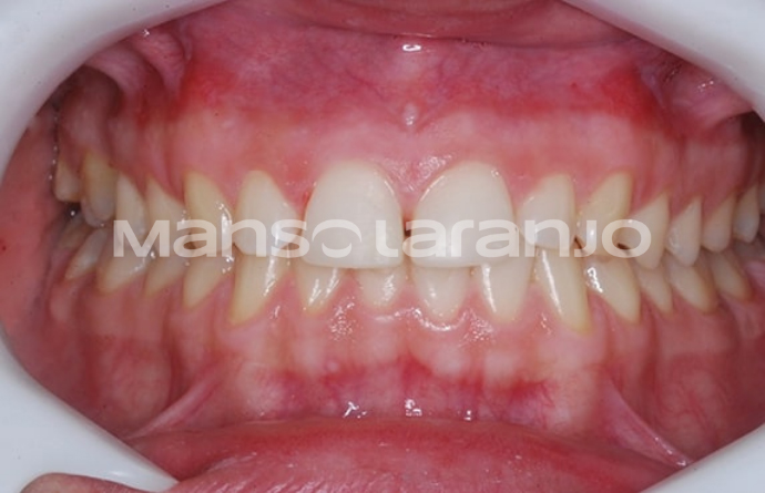 Tratamento Dentário - Clínica Manso Laranjo