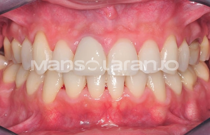 Tratamento Dentário - Clínica Manso Laranjo