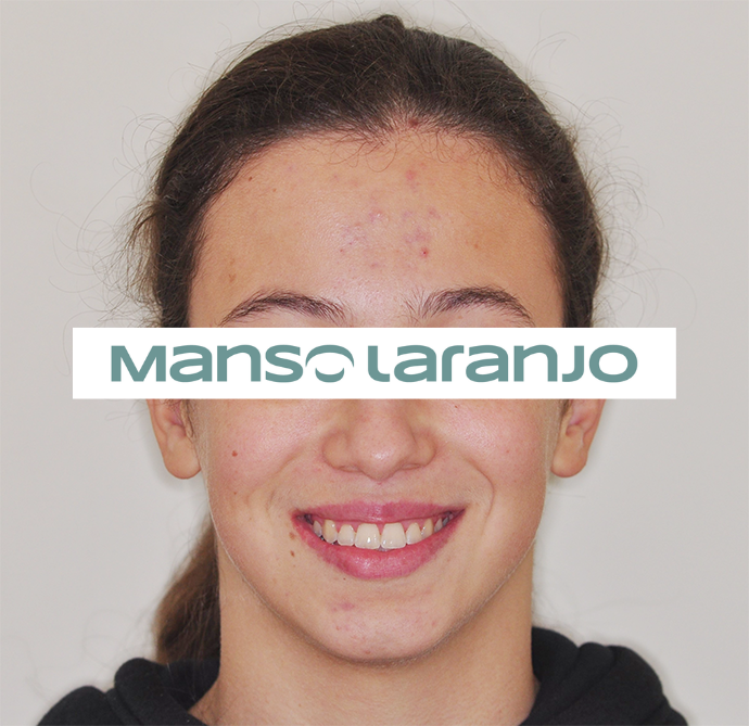 Tratamento Dentário - Clínica Manso Laranjo