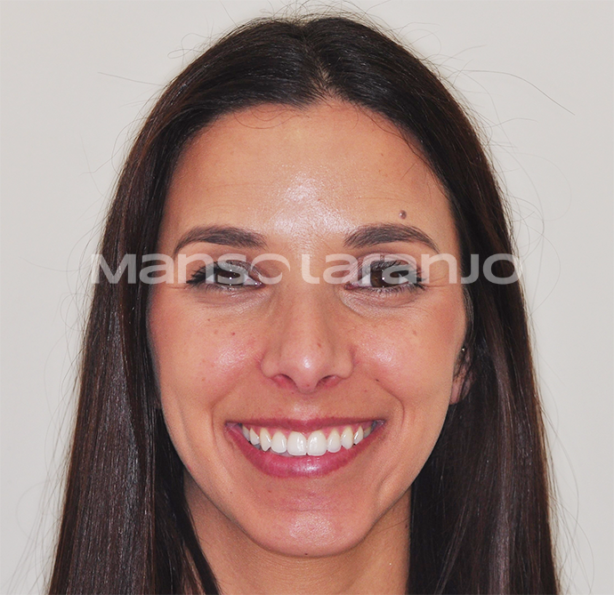 Tratamento Dentário - Clínica Manso Laranjo