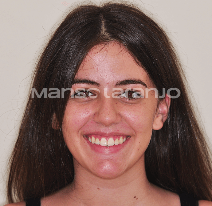 Tratamento Dentário - Clínica Manso Laranjo