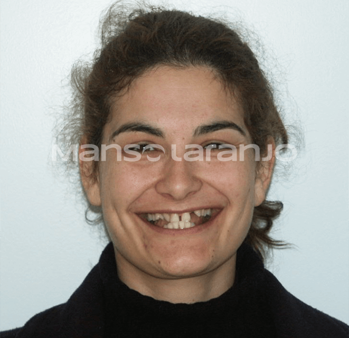 Tratamento Dentário - Clínica Manso Laranjo