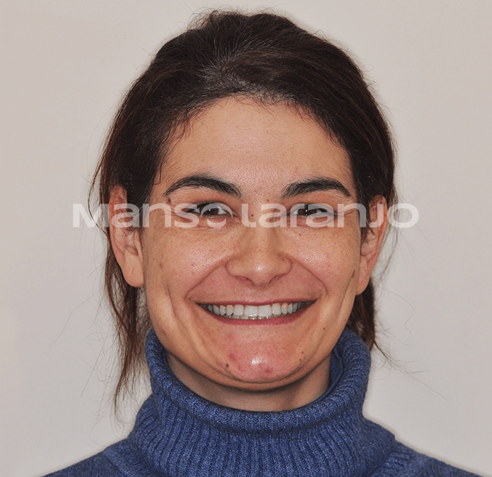 Tratamento Dentário - Clínica Manso Laranjo