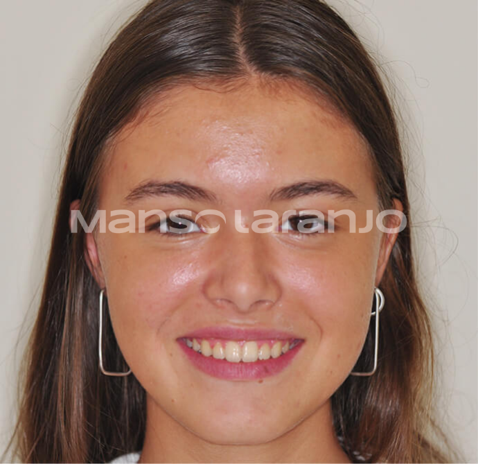 Tratamento Dentário - Clínica Manso Laranjo